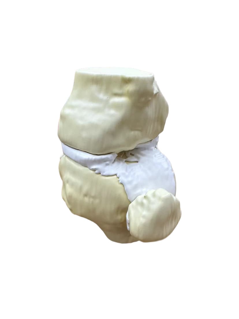 3D打印膝关节模型